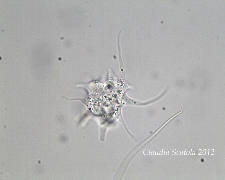 Astramoeba sp. ( Amoeba radiosa )